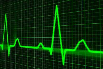 Praktyczne aplikacje scalonych układów AFE (2). Podział funkcjonalny front-endów. Podstawy pomiarów biomedycznych